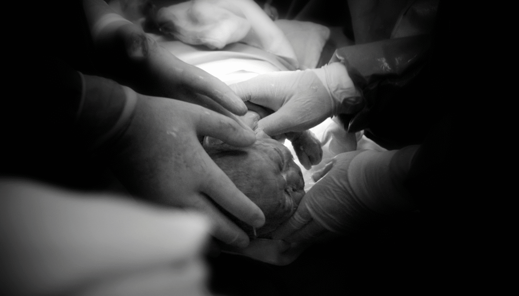 השפעת מספר ניתוחים קיסריים על הריונות עתידיים